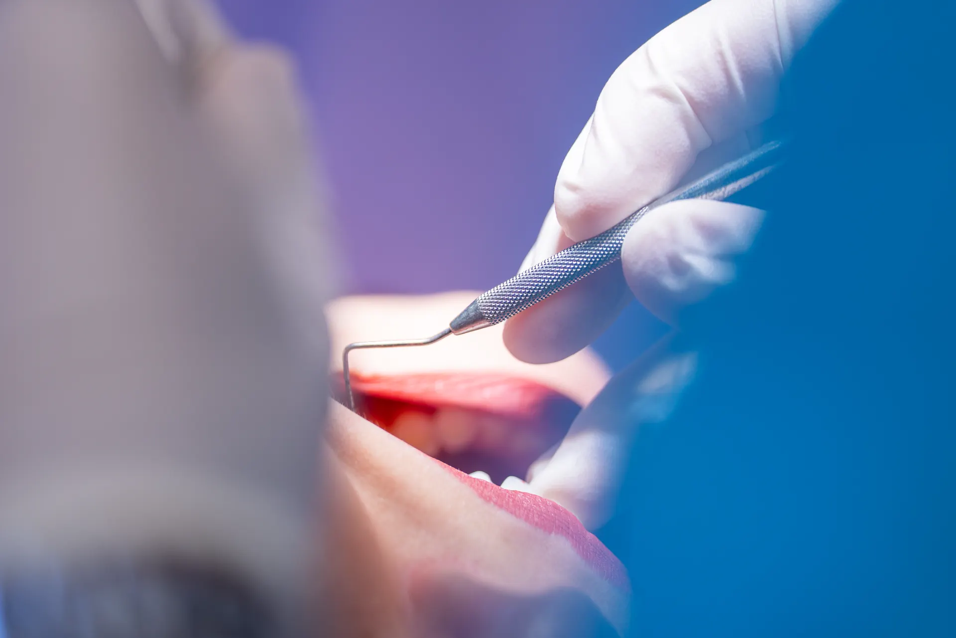 Odontoiatra durante una seduta di terapia parodontale